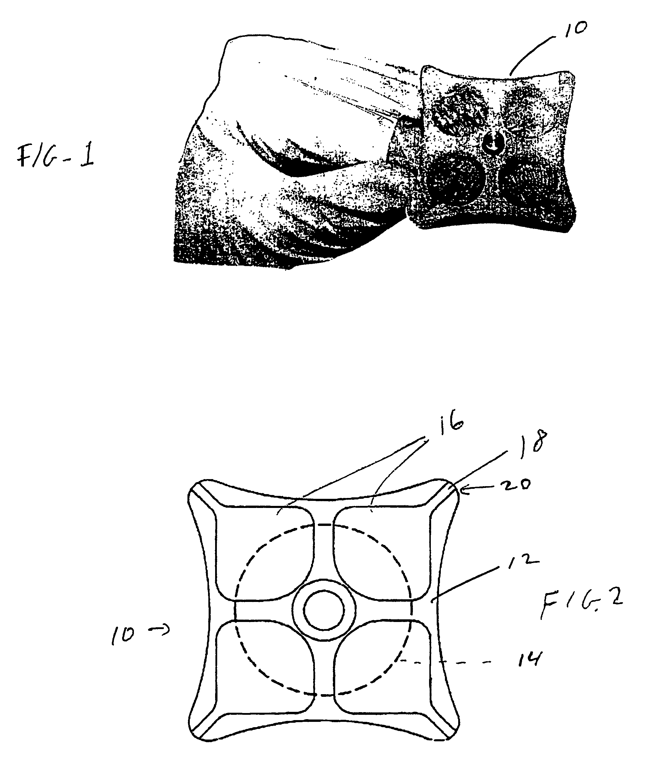 Tissue graft support apparatus