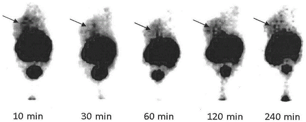 Technetium-99m labelled Melphalan complex as well as preparation method and application thereof