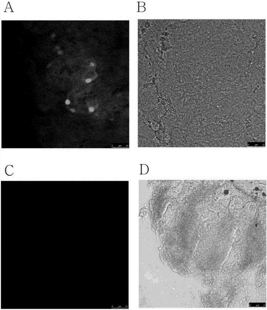 Detection method for expression of GPR120 gene based on eGFP, and application of eGFP to detection of expression of GPR120 gene