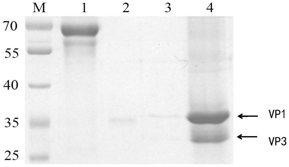 Coxsackie virus B5 type virus-like particle as well as preparation method and application thereof