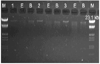 Method for safely and quickly extracting genomic deoxyribose nucleic acid (DNA) from blood