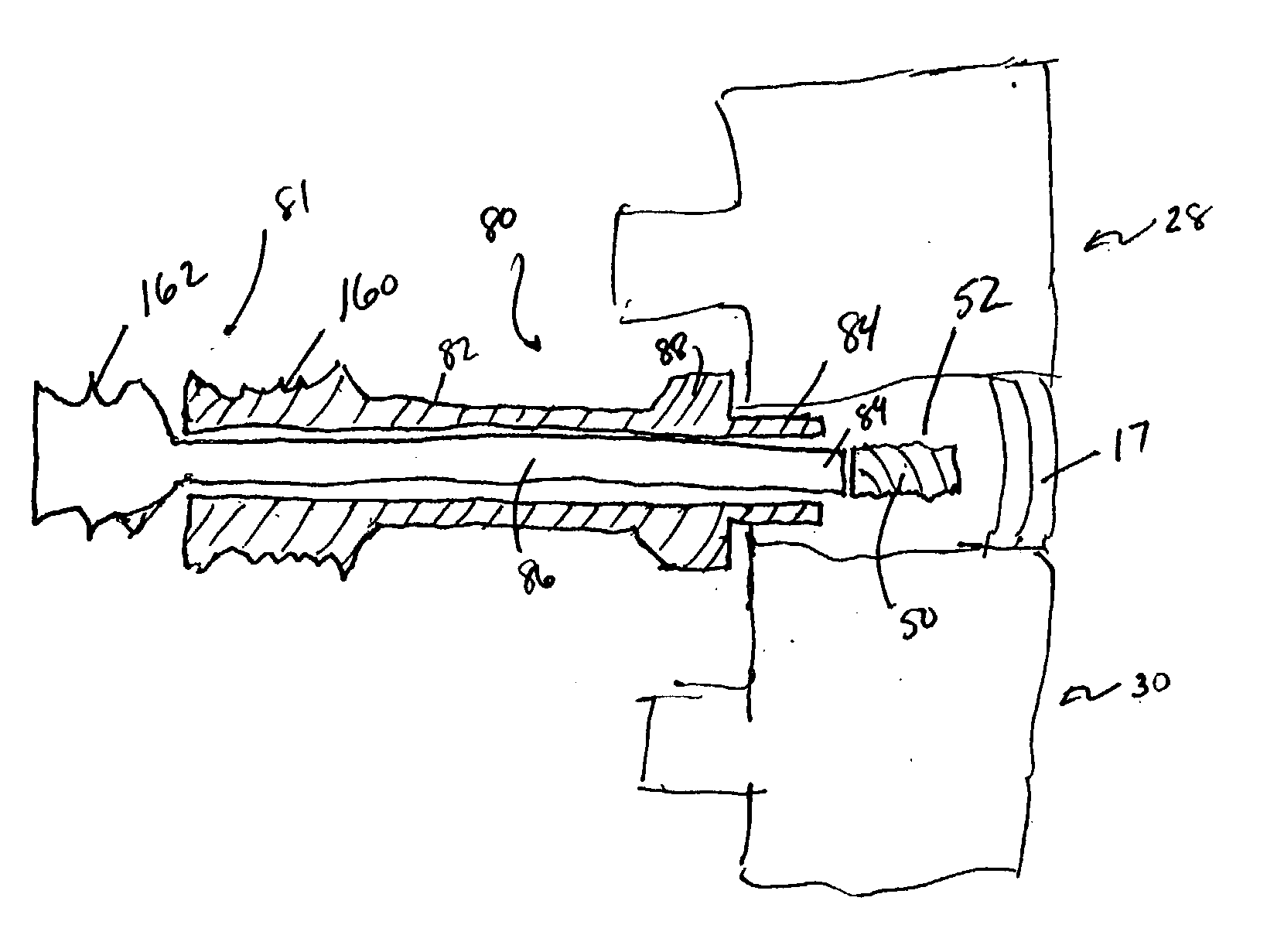 Devices and method for augmenting a vertebral disc