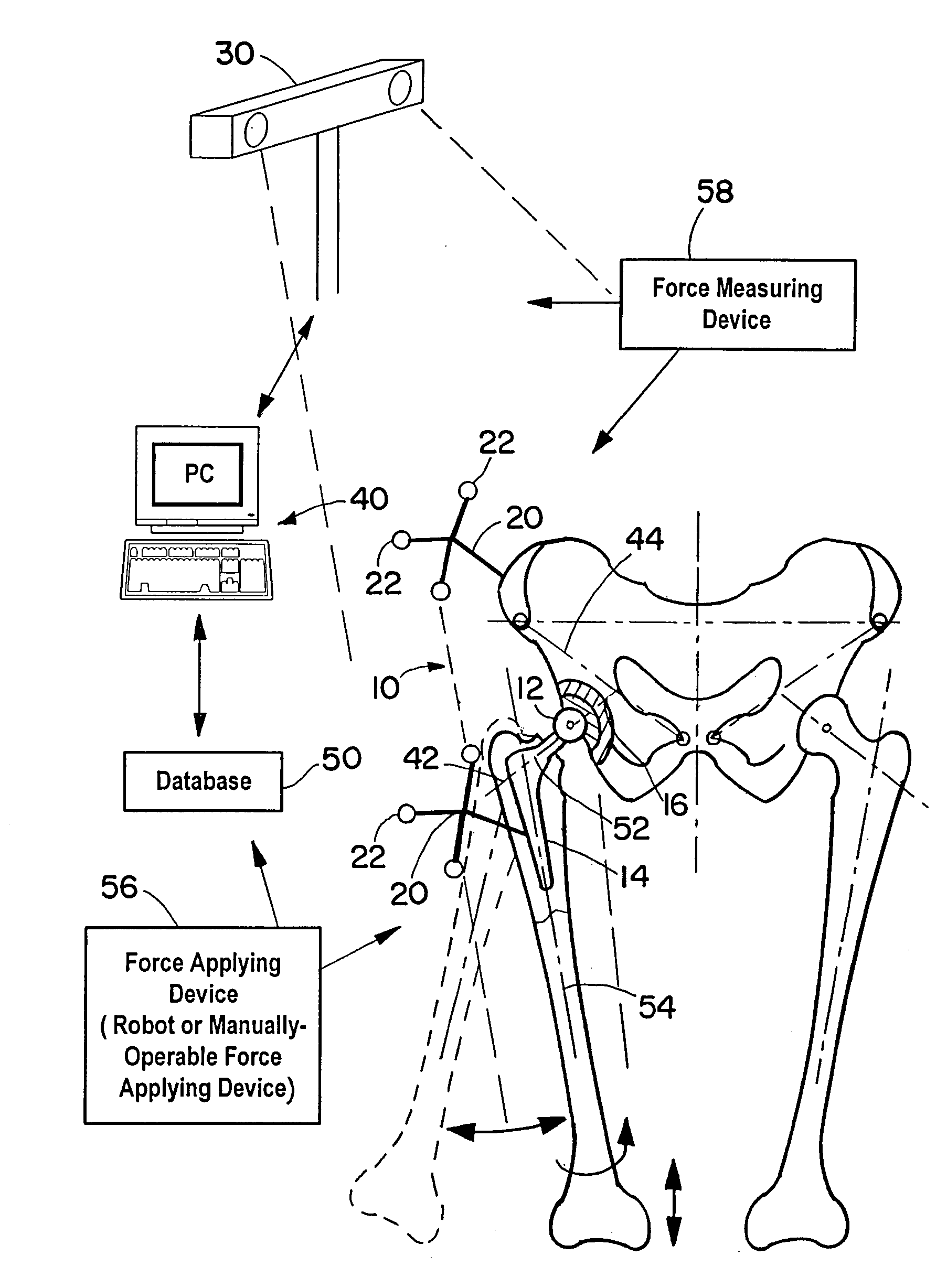 Device and method for determining the aperture angle of a joint