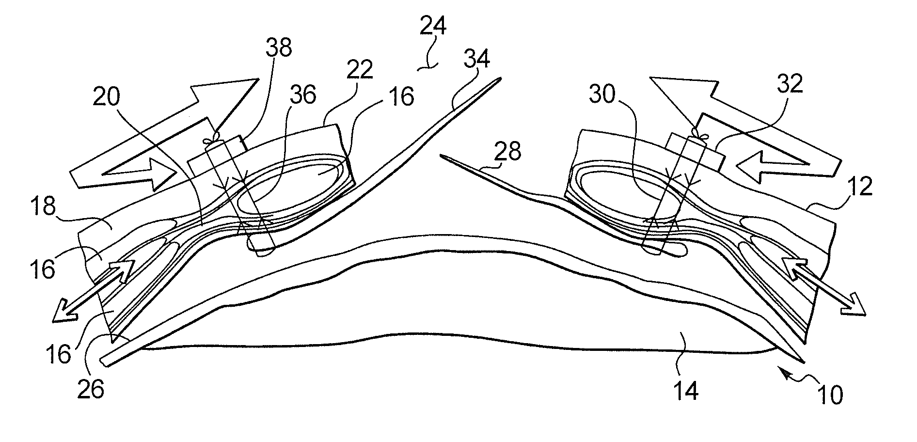 Method and apparatus for surgically closing an open abdomen