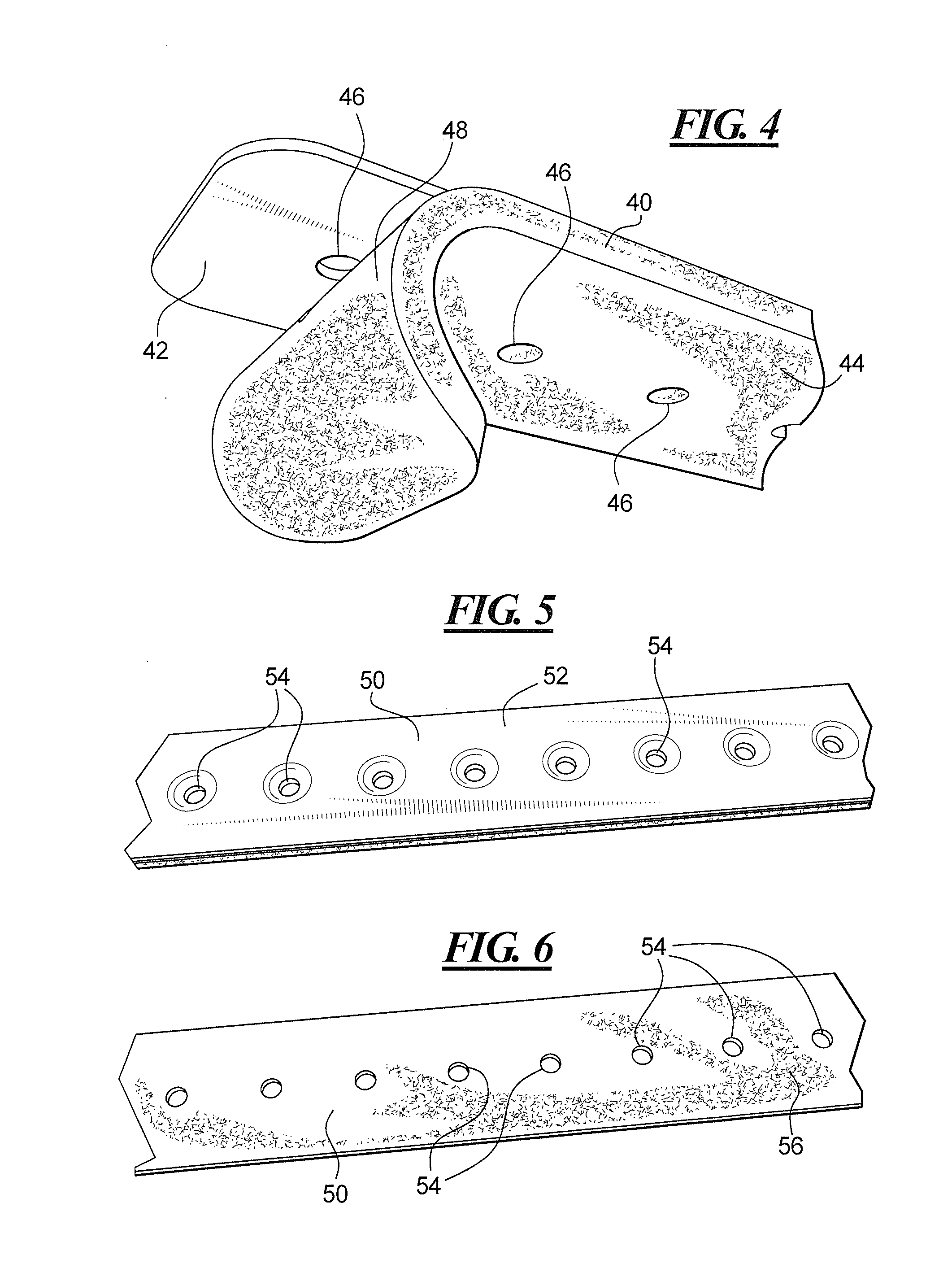 Method and apparatus for surgically closing an open abdomen