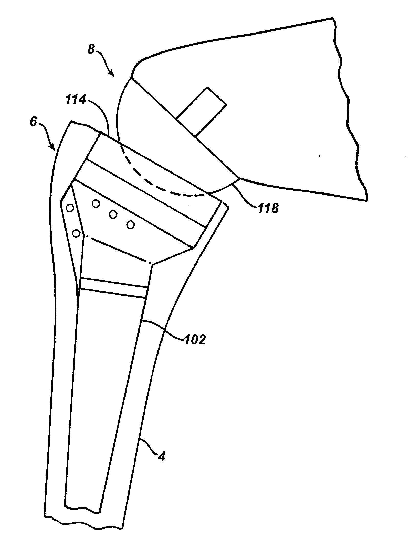 Extended articulation prosthesis adaptor and associated method