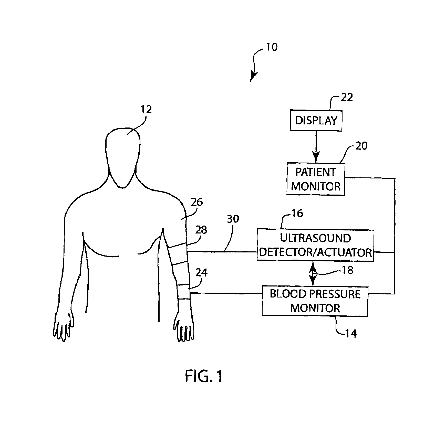 Method and apparatus for automated flow mediated dilation