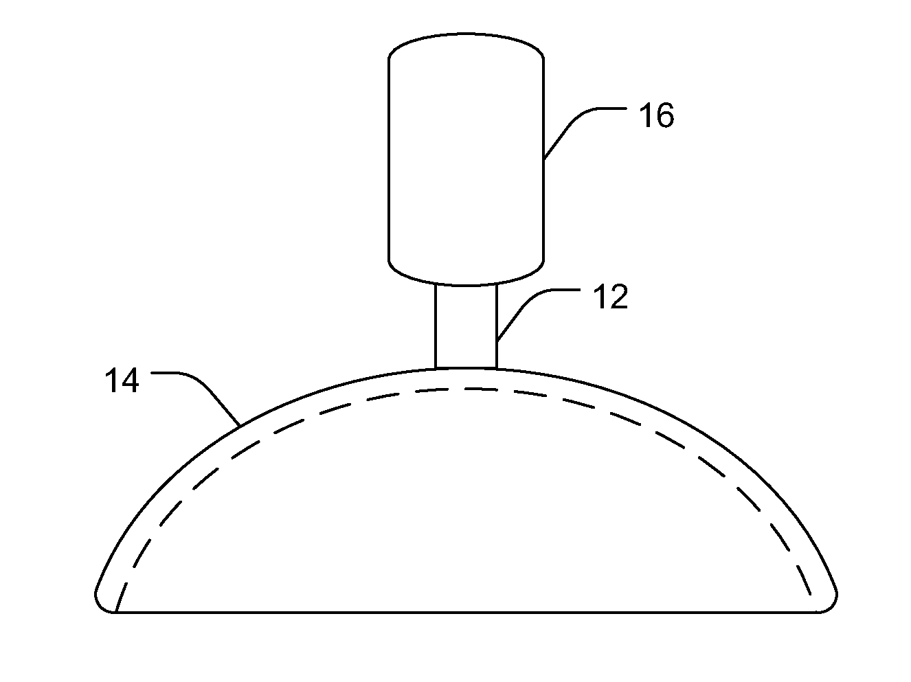 Intraocular iontophoretic device and associated methods