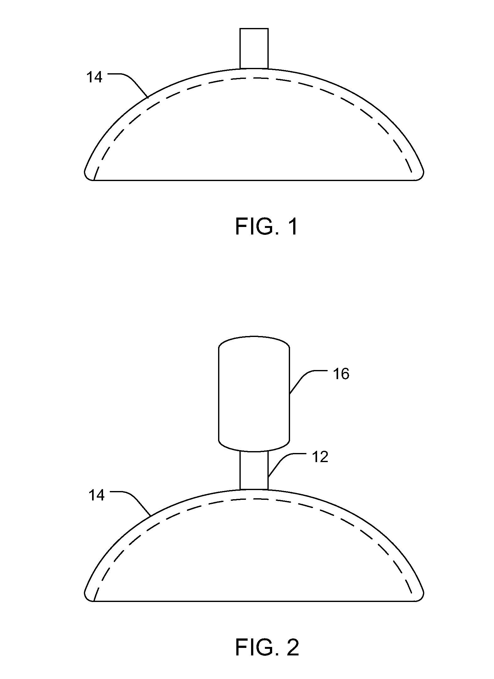 Intraocular iontophoretic device and associated methods