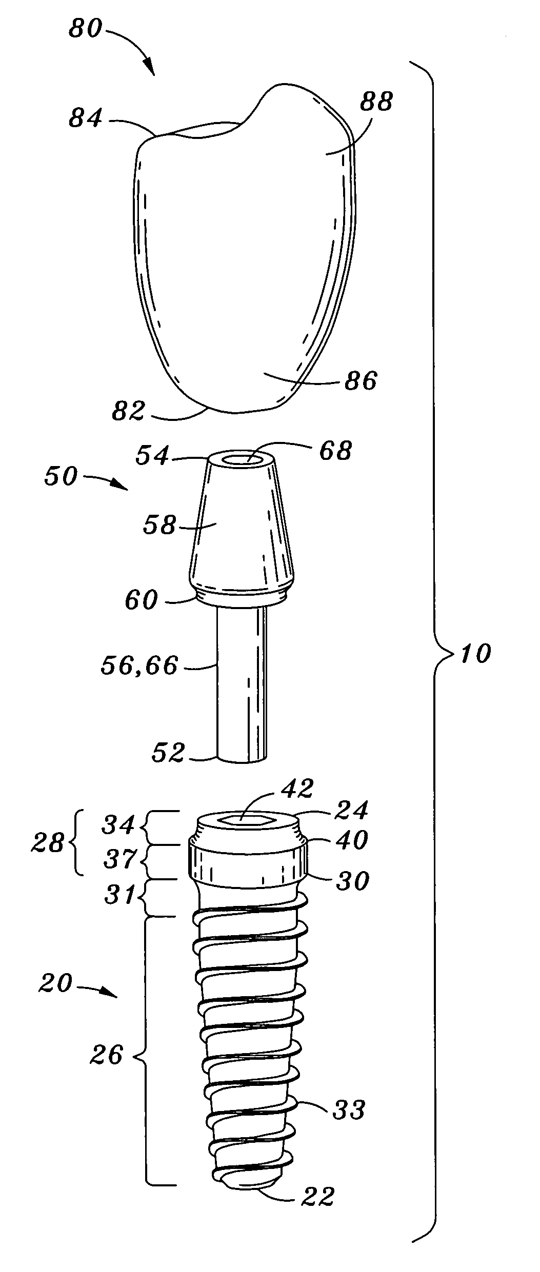 Dental implant