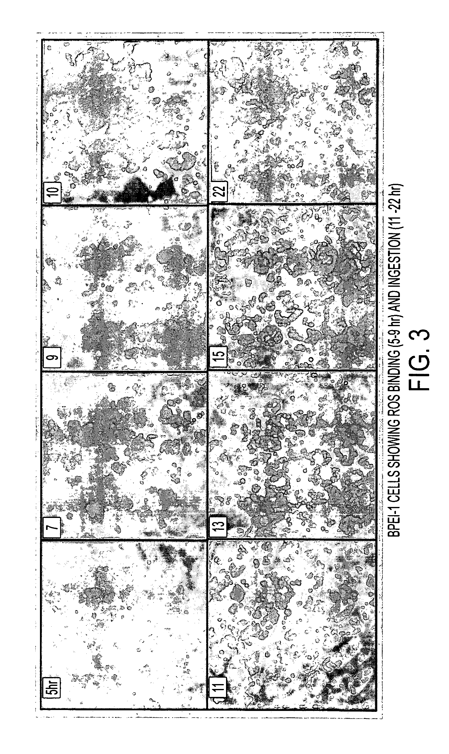 Methods and compositions for detecting and treating retinal diseases