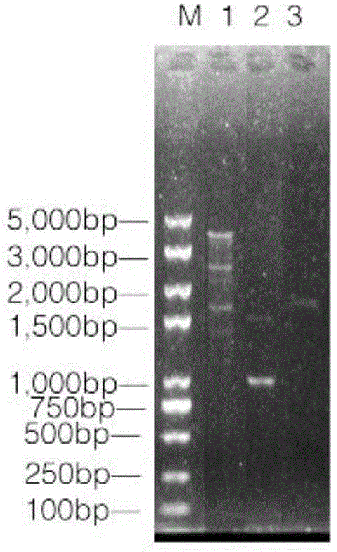 Streptococcus mutans surface protein antigen (SpaP) and glucosyltransferase (GtfB) fused protein vaccine and preparation method thereof