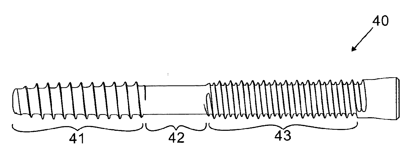 Double Threaded Orthopedic Screw