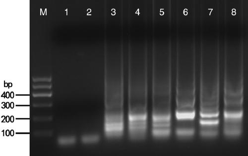 IC-RT-LAMP (loop-mediated isothermal amplification) detection method for specially detecting LNYV (Lettuce necrotic yellows virus)