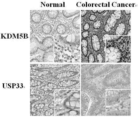 Mutated ubiquitin specific protease 33 gene and application of mutated ubiquitin specific protease 33 gene