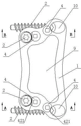 Anterior cervical pedicle screw plate fixing system