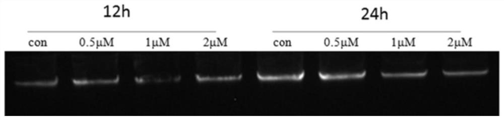 Method for jointly detecting whole genome DNA adduct based on dot blot hybridization and chromatin co-immunoprecipitation sequencing