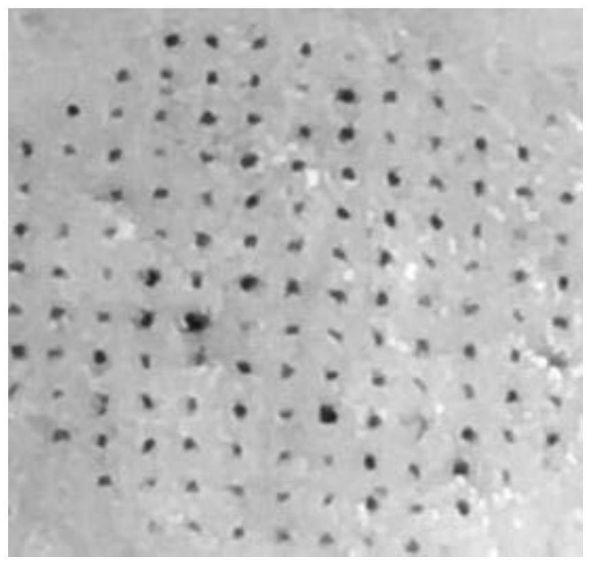 Sustained-release microneedle patch and preparation method thereof