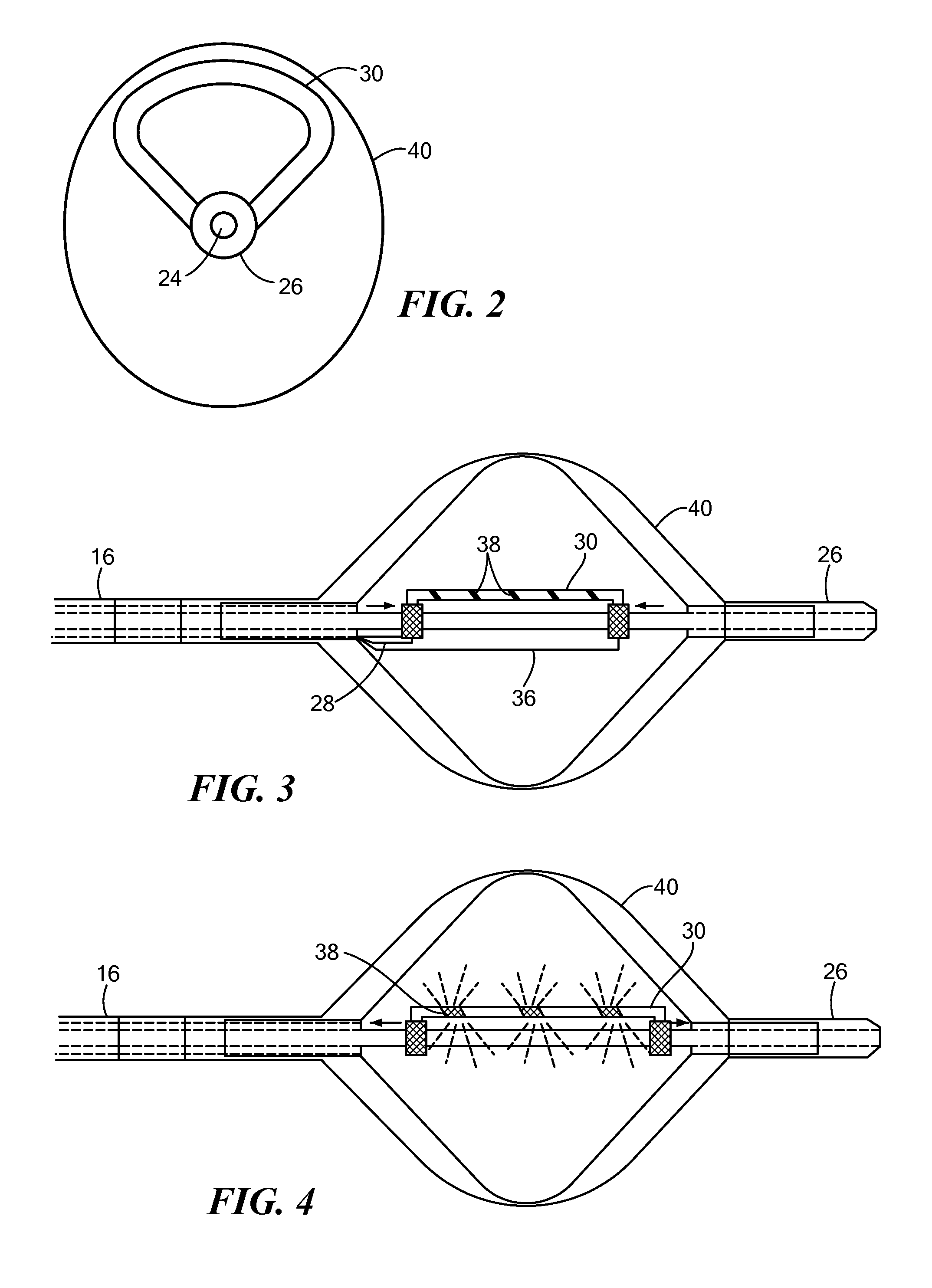 Balloon catheter with deformable fluid delivery conduit