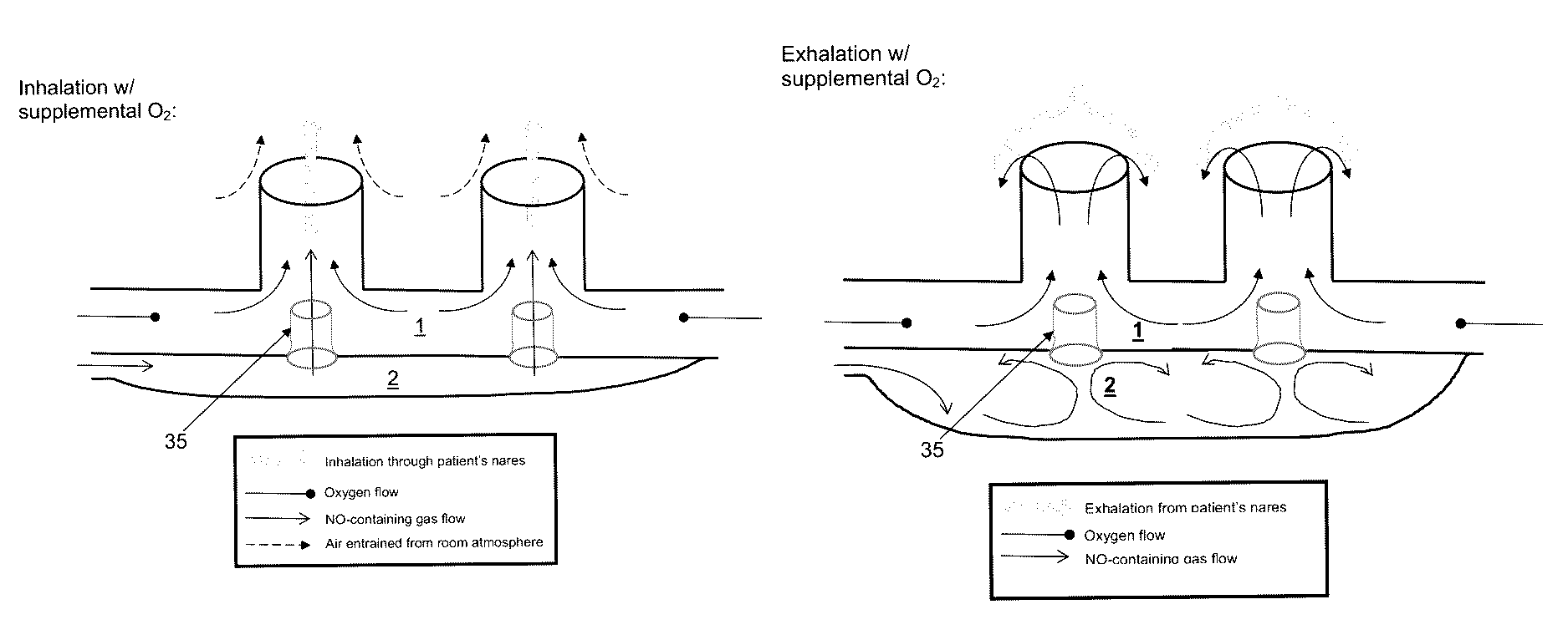 Method of delivering medical gases via a nasal cannula assembly with flow control passage communicating with a deformable reservoir