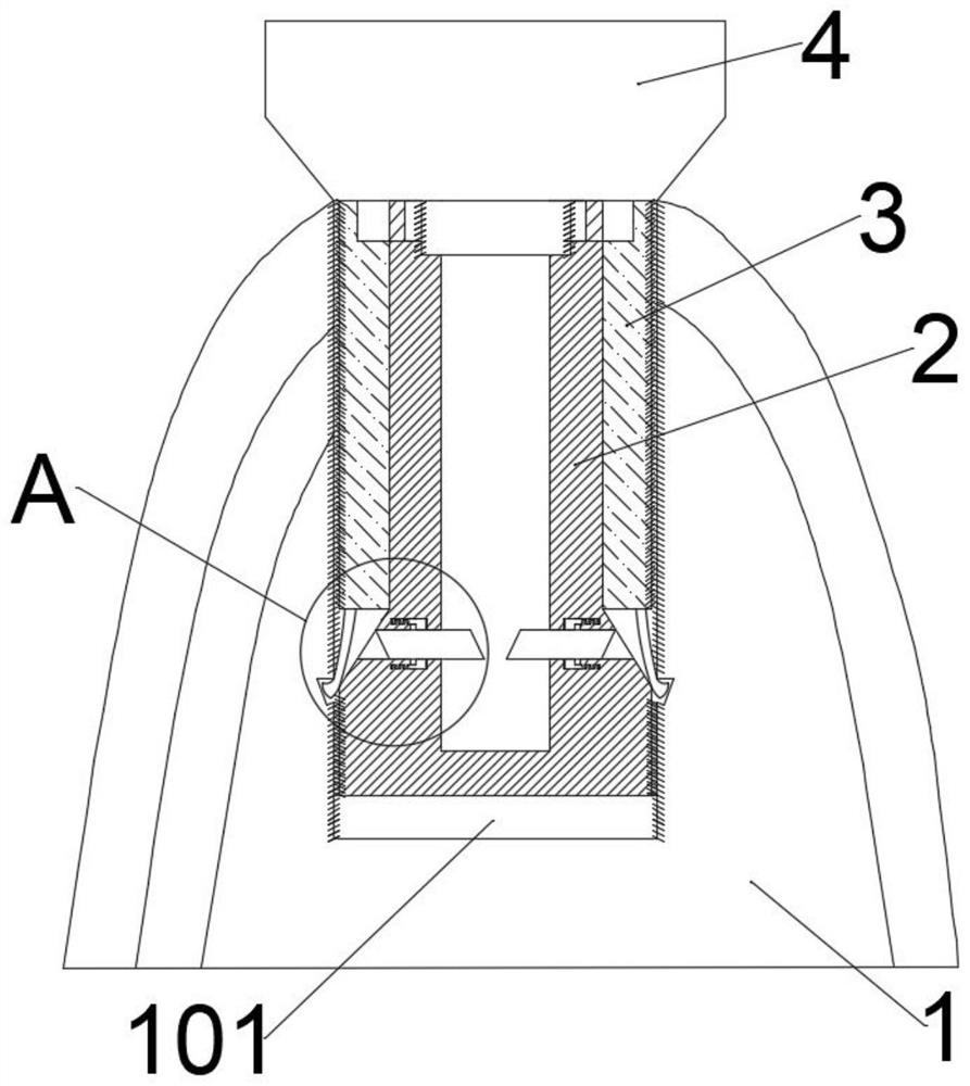 Dental implant system