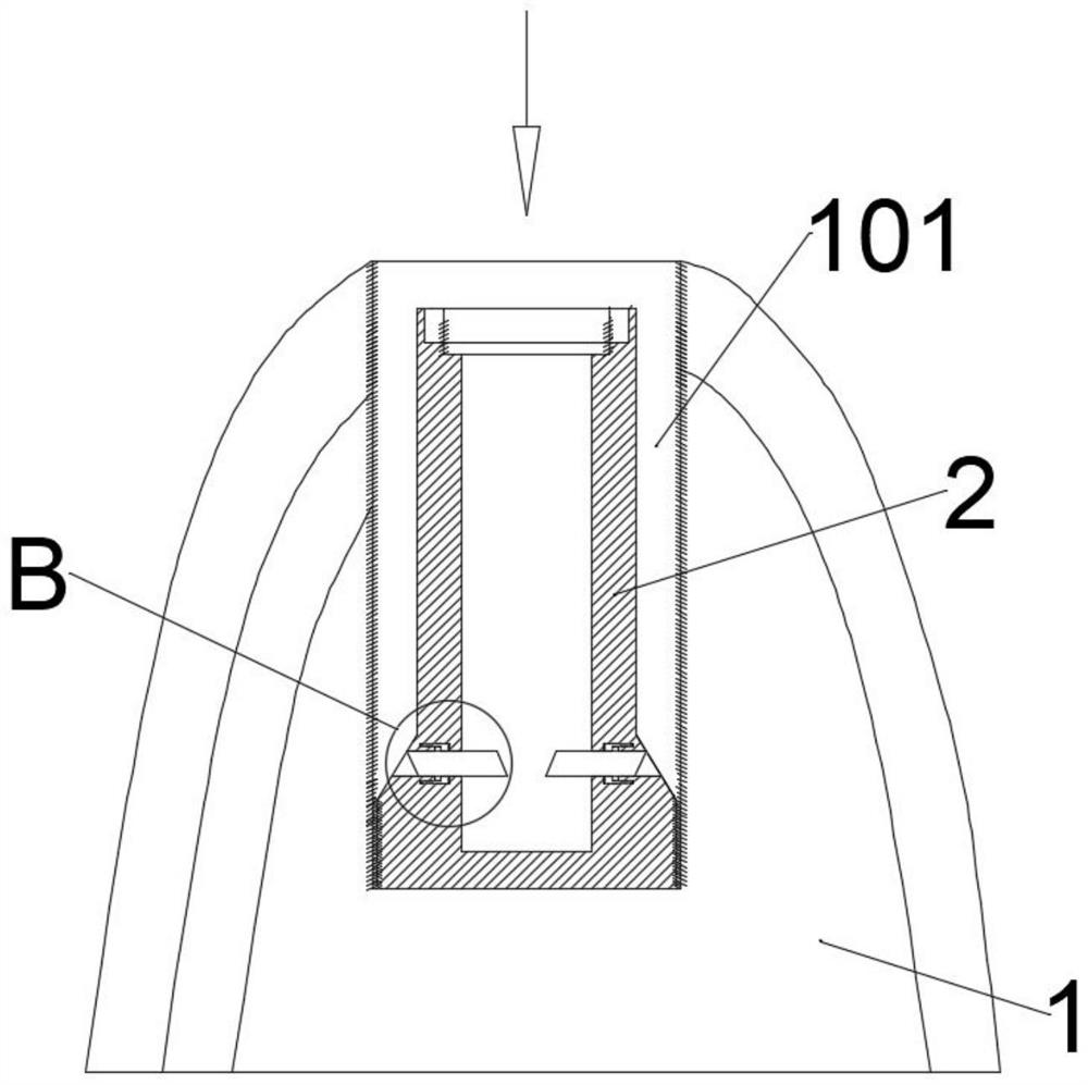 Dental implant system