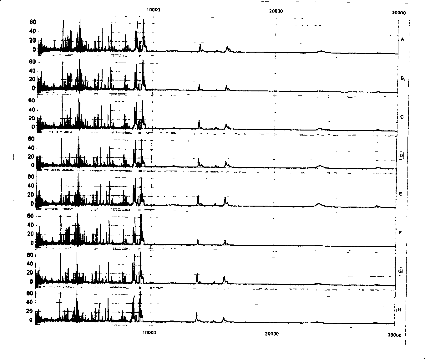 Standard reagent kit for mass spectrometry clinical diagnosis and the method