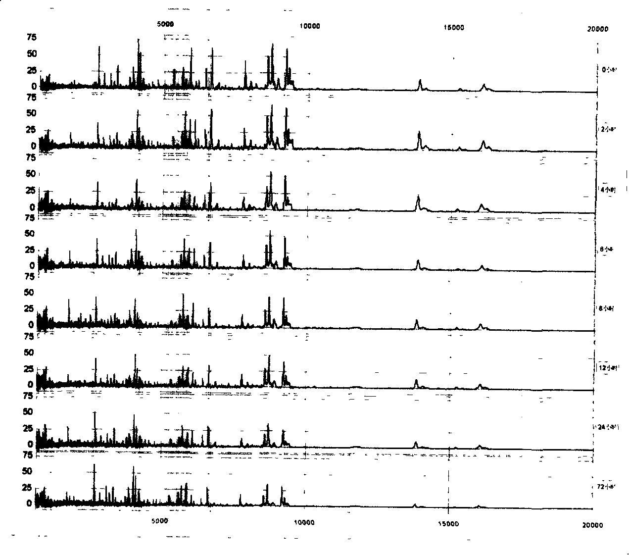 Standard reagent kit for mass spectrometry clinical diagnosis and the method