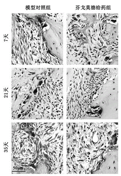 Application of Fingolimod in treatment of periapical periodontitis