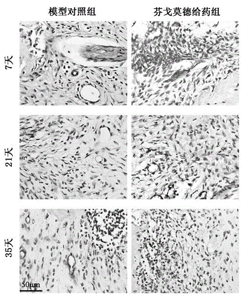 Application of Fingolimod in treatment of periapical periodontitis