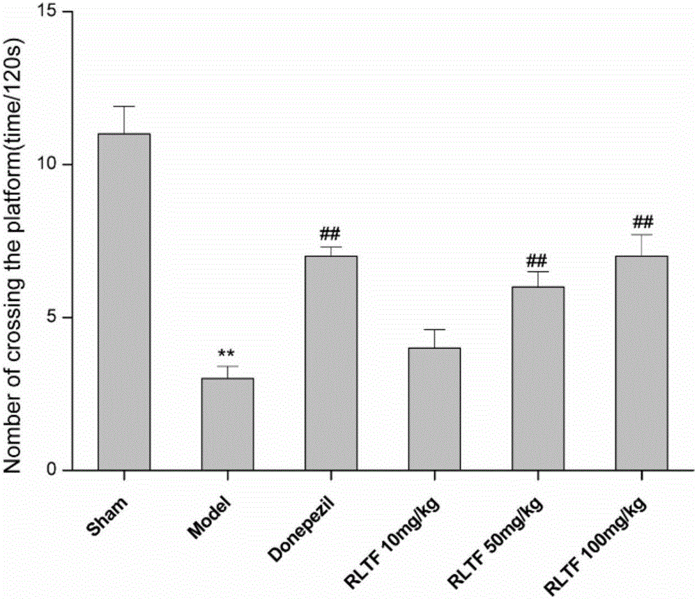 Extraction technology of total flavonoids with anti-AD (Alzheimer's disease) activity in leaves of red raspberry