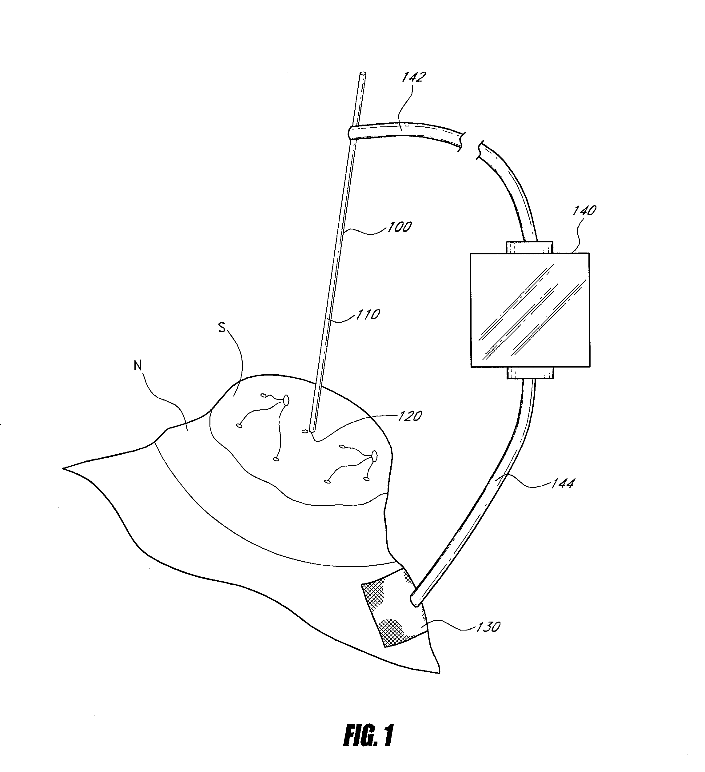 Device and method for accessing and treating ducts of mammary glands