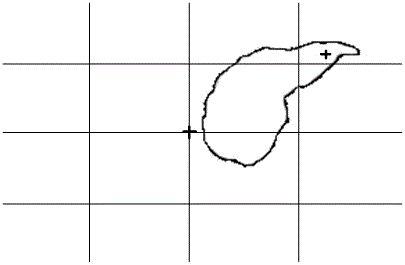 Cursor movement method for medical display, cursor movement device and medical equipment