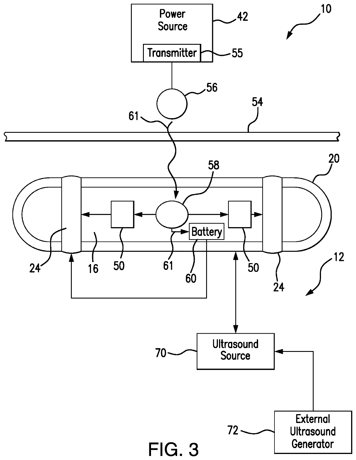 Pacemaker system equipped with a flexible intercostal generator