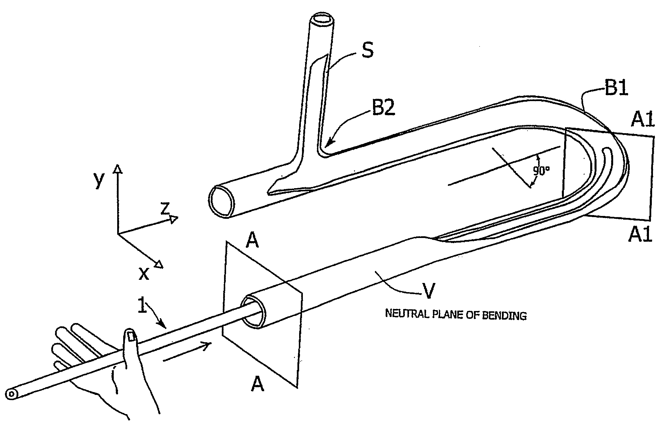 Catheter