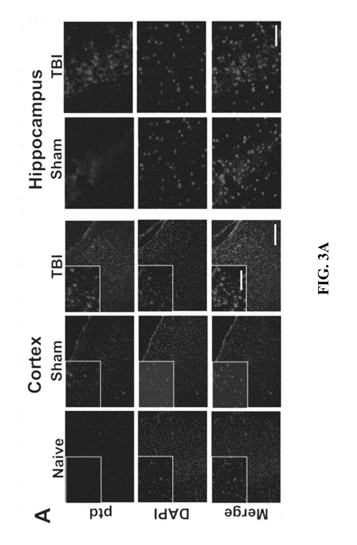 Methods of using multilayer magnetic micelle compositions