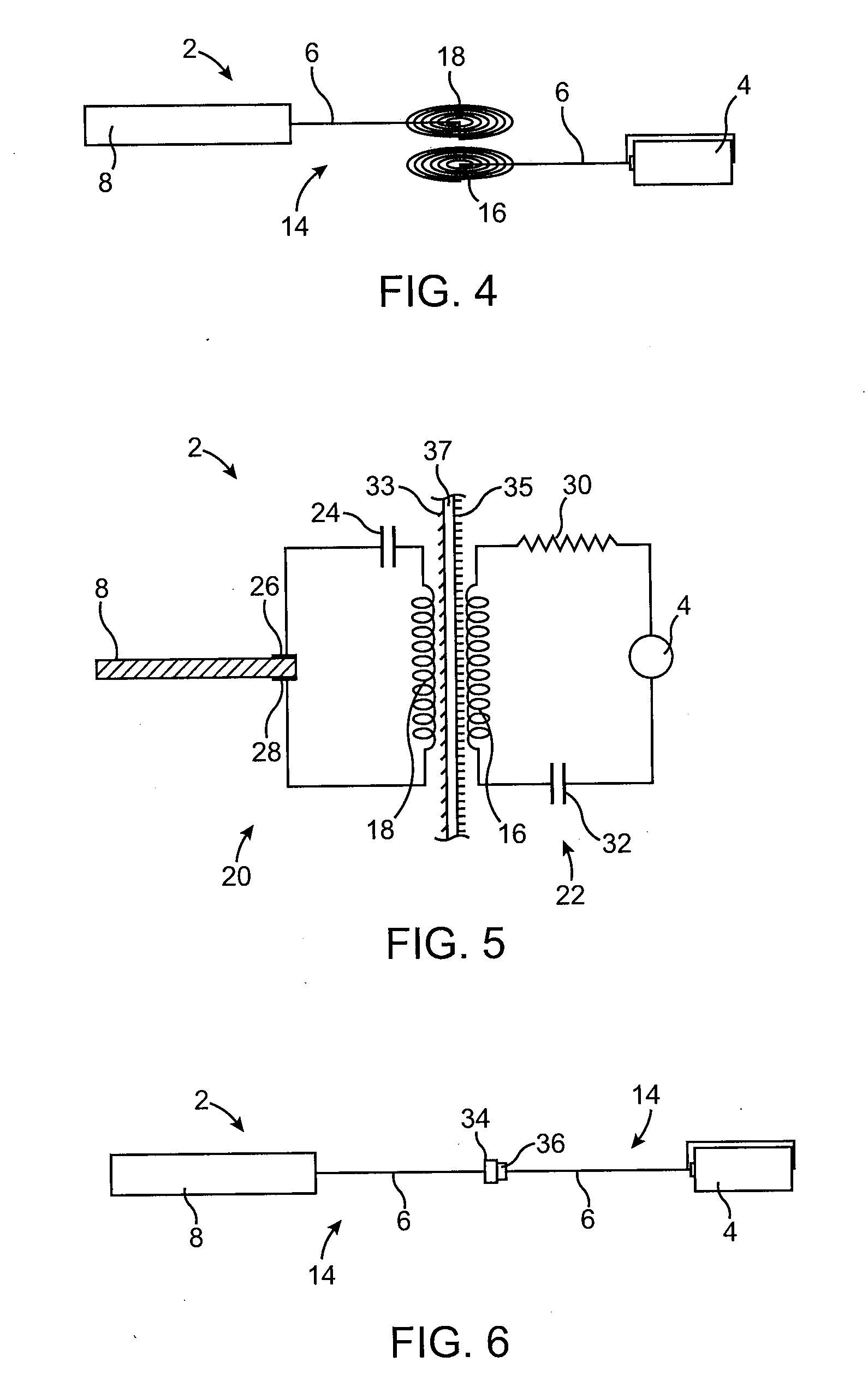 Inductive power transfer system for palatal implant