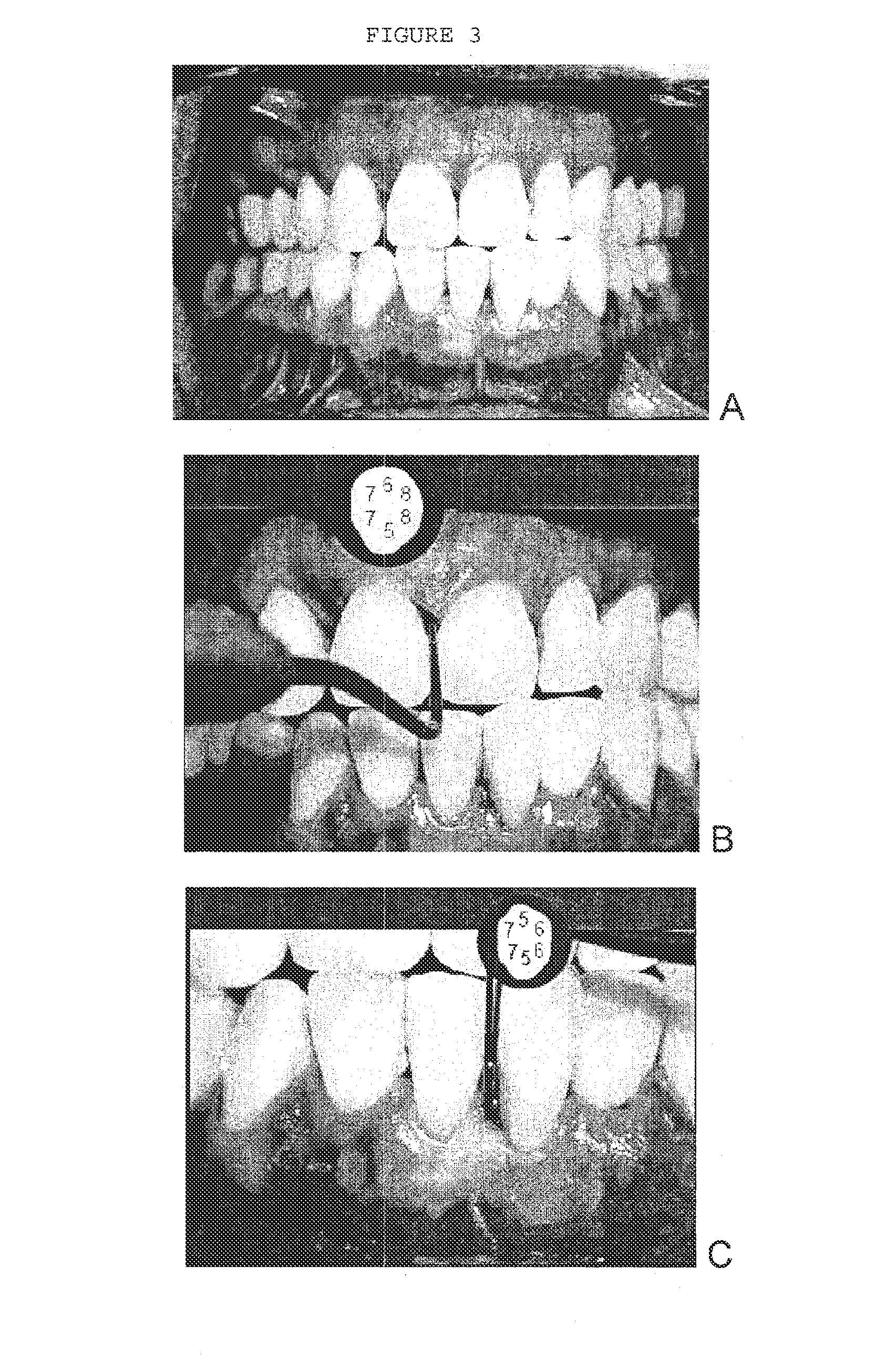 Combination of an oxidant, a photosensitizer and a wound healing agent for oral disinfection and treatment of oral disease