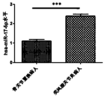 Application of hsa-miR-17-5p as diagnostic marker of rheumatoid arthritis