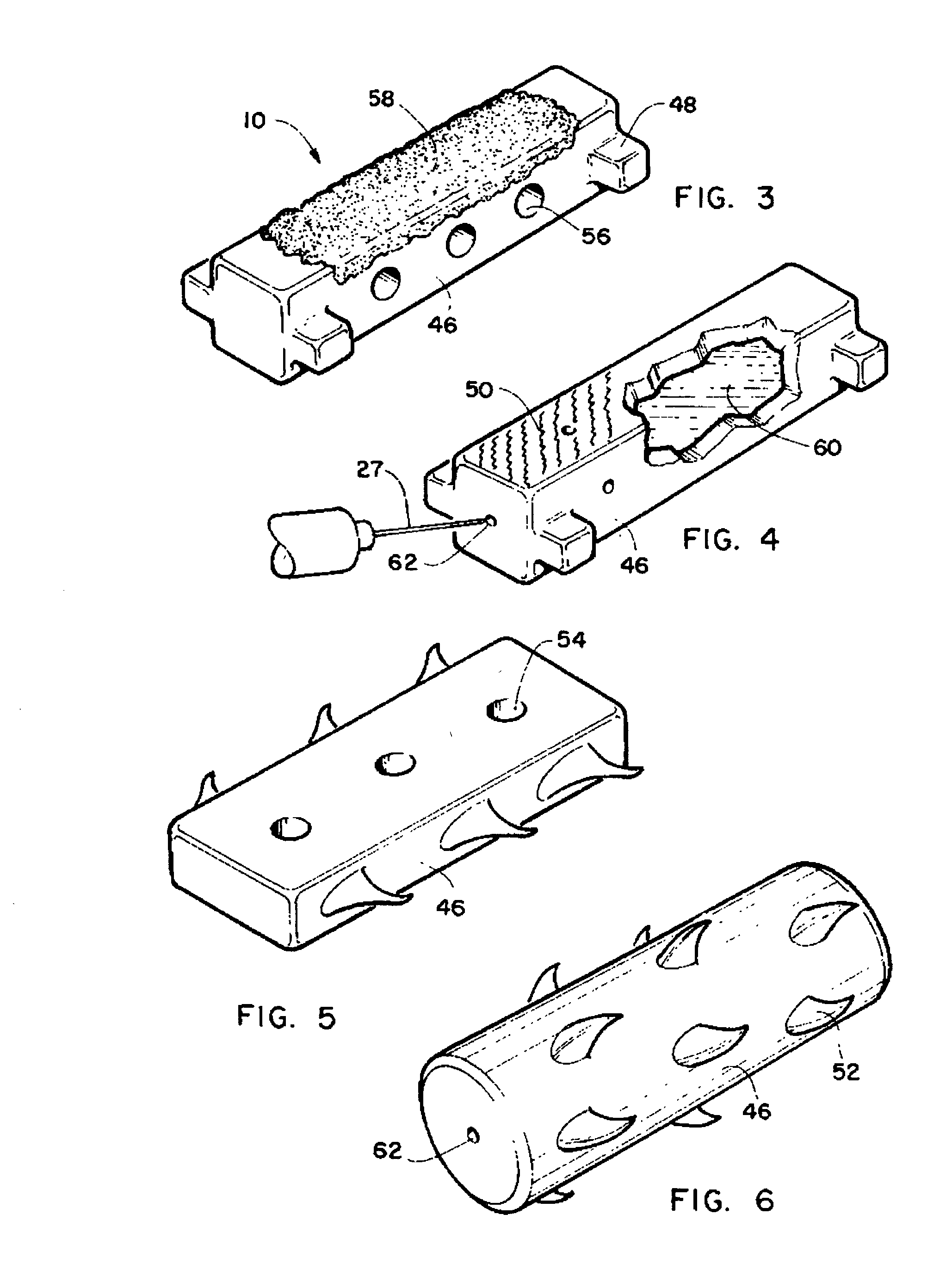 Method and intra sclera implant for treatment of glaucoma and presbyopia