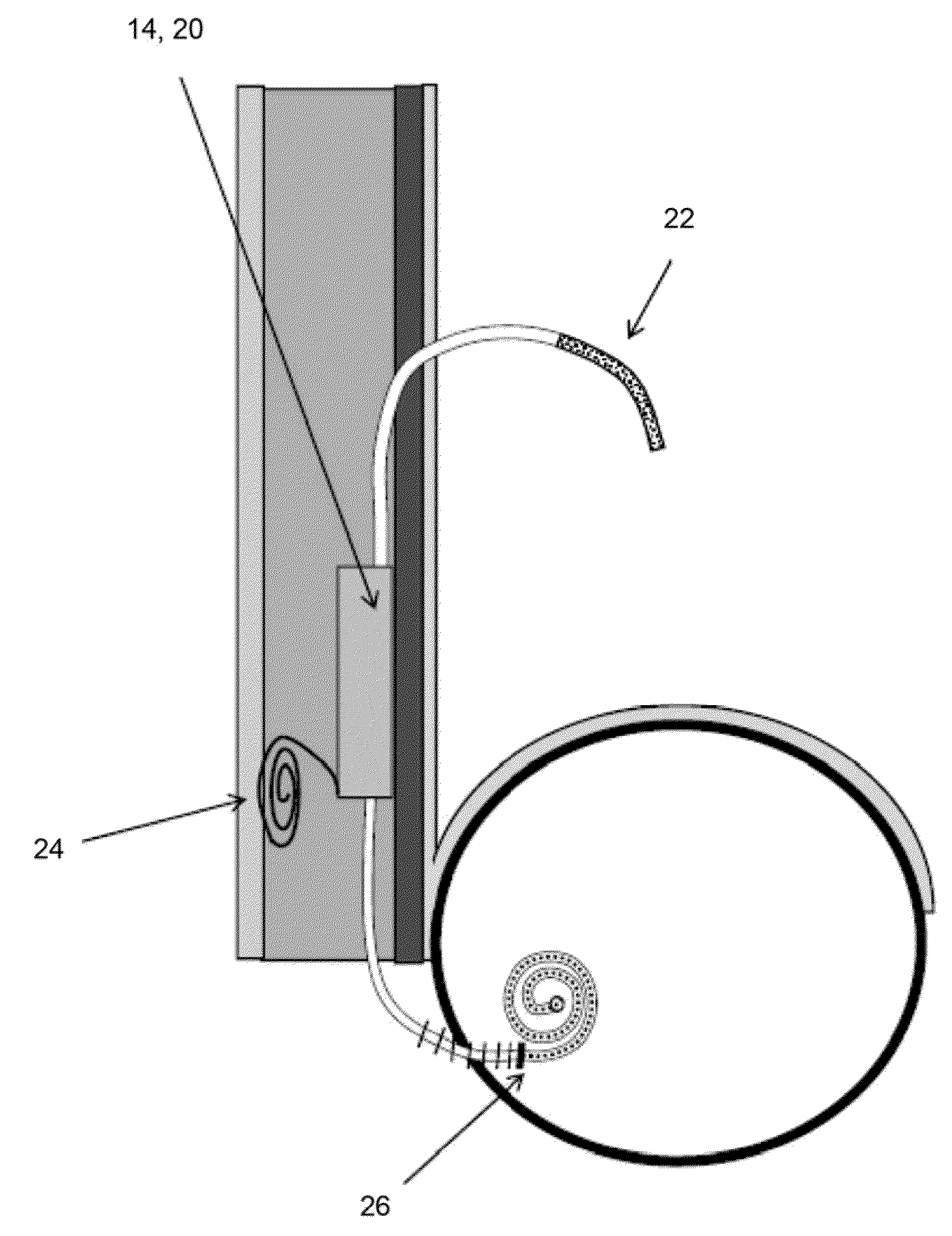 Method and apparatus for automated active sterilization of fully implanted devices