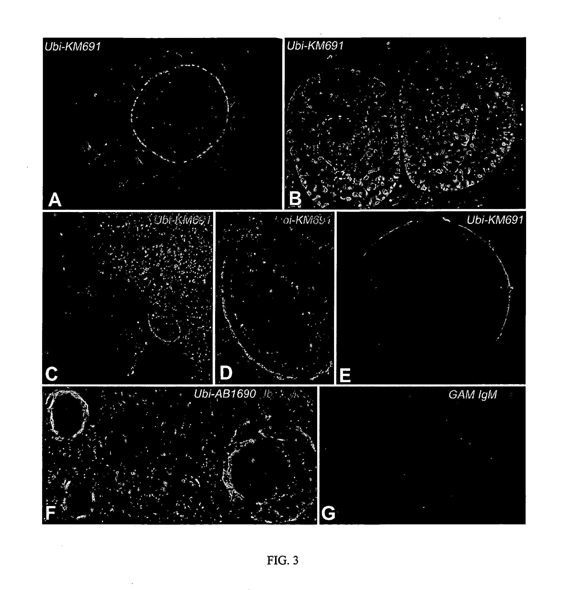 Contraceptive methods and compositions related to proteasomal interference