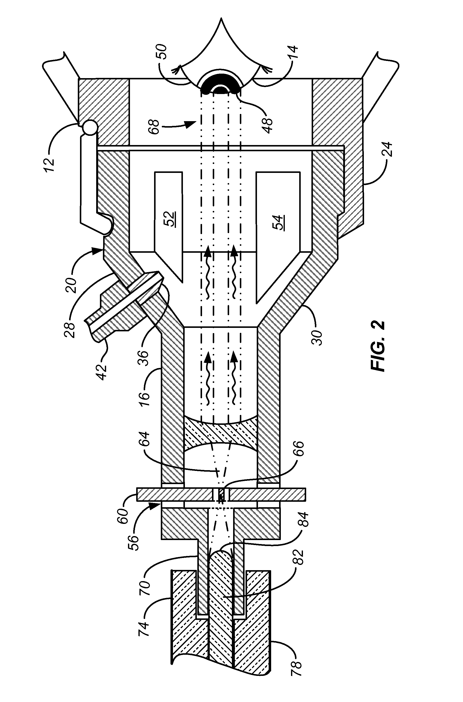 In Situ UV/Riboflavin Ocular Treatment System