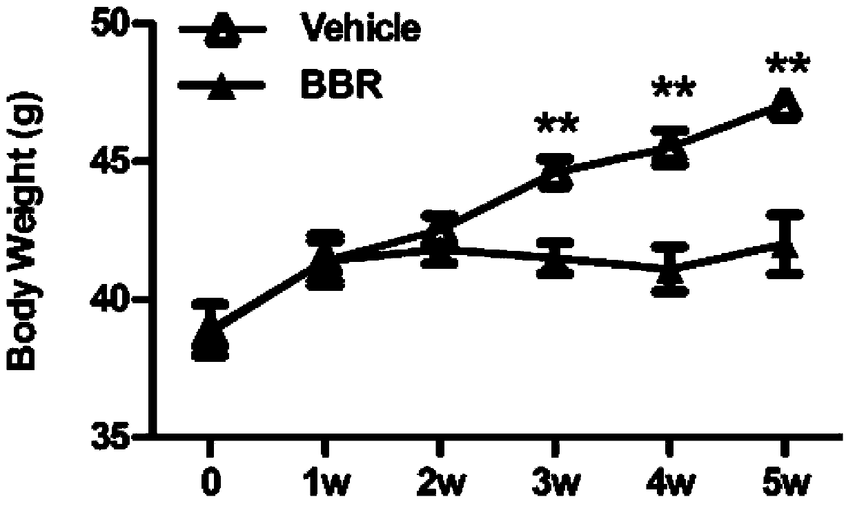 Application of berberine in medicine for treating non-alcoholic fatty liver disease