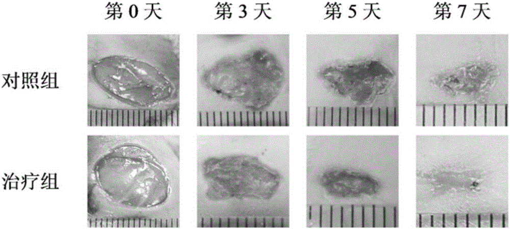 Gel dressing based on G-quadruplex/collagen, as well as preparation and application of gel dressing