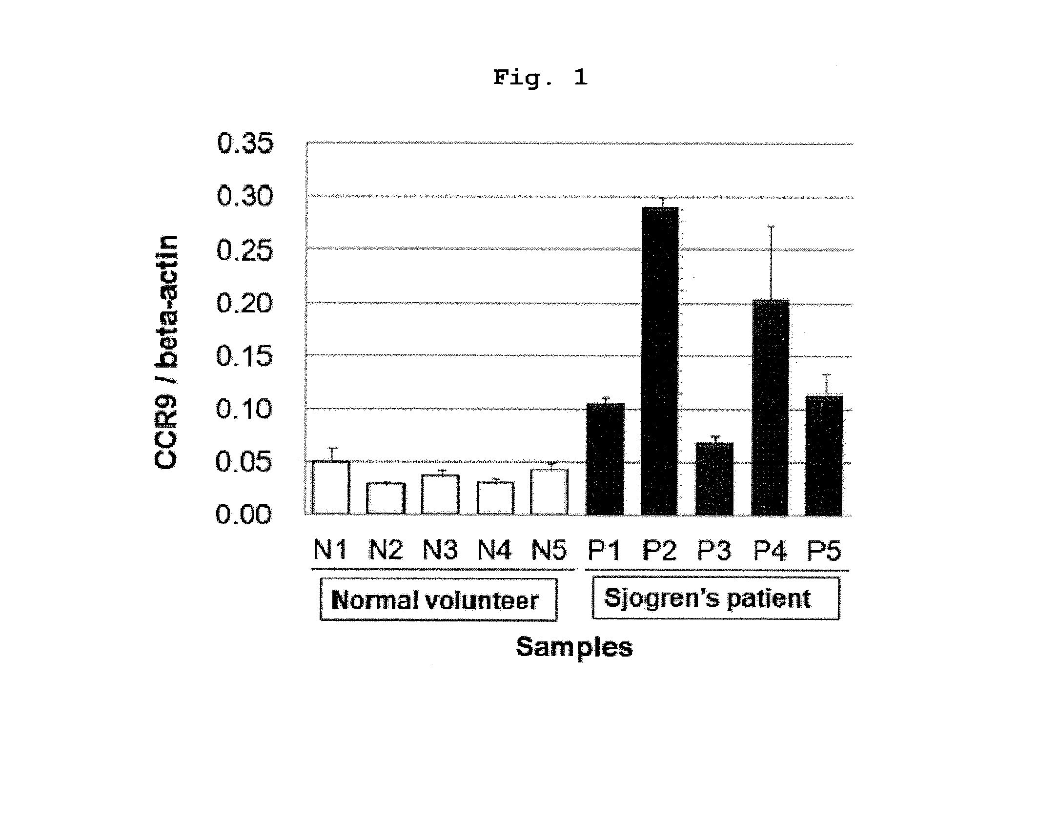 Prophylactic or therapeutic method for sjogren's syndrome