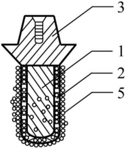 Individual biomimetic dental implant and making method thereof