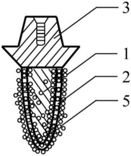 Individual biomimetic dental implant and making method thereof