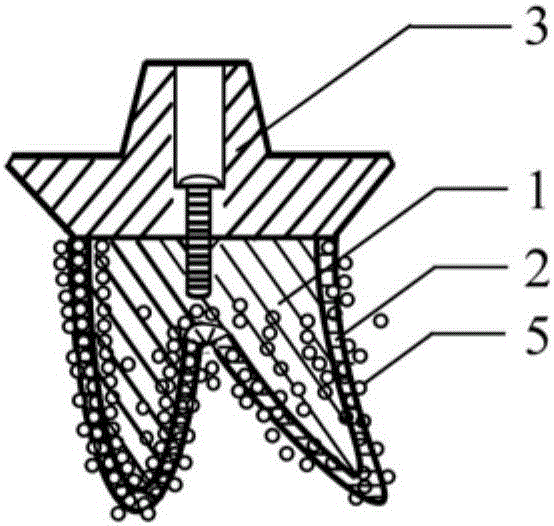 Individual biomimetic dental implant and making method thereof