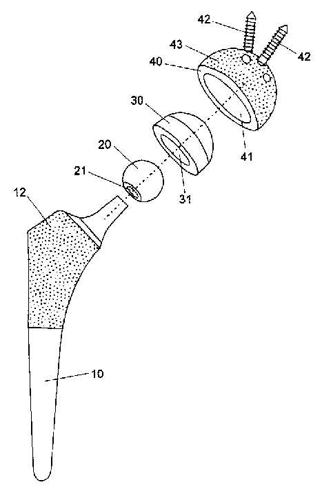 Artificial joint made from zirconia-alumina composite ceramic